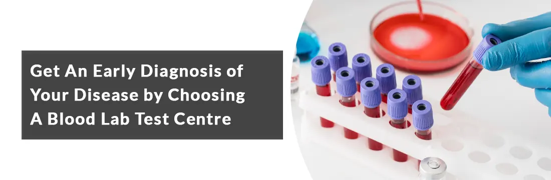 Early Diagnosis of Your Disease by Choosing a Blood Lab Test Centre